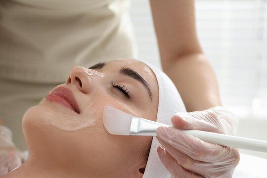 Chemical Peel for Acne